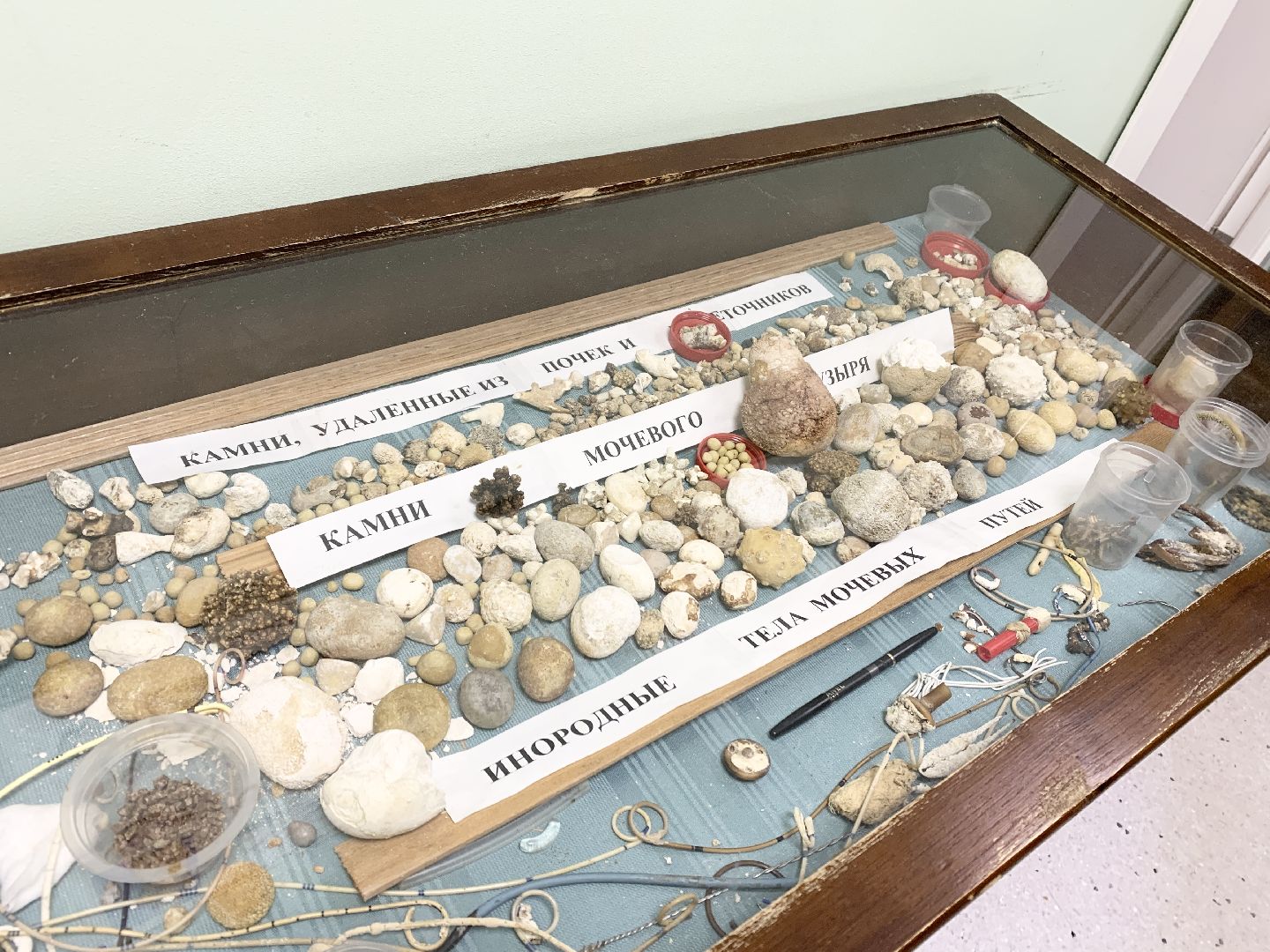 Балашиха, Подмосковье, балашихинская больница, цистоскоп, новое медоборудование,