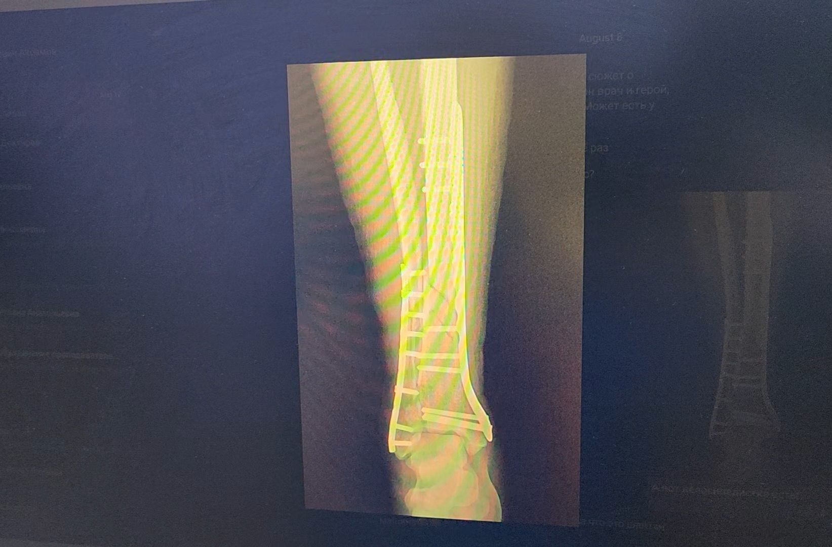 Солнечногорск, медицина, травматология, велосипед,