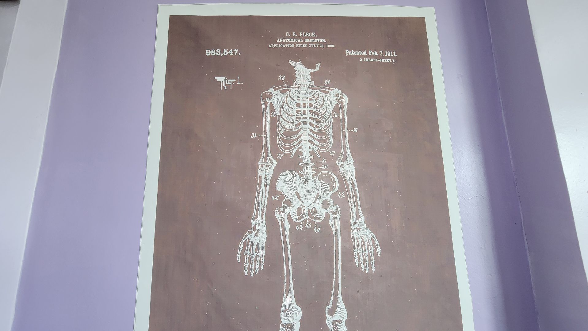 Солнечногорск, медицина, травматология, велосипед,