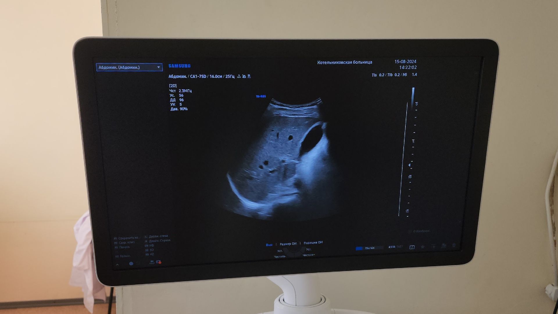 узи-диагностика, аппарат узи, новая медтехника, национальный проект,