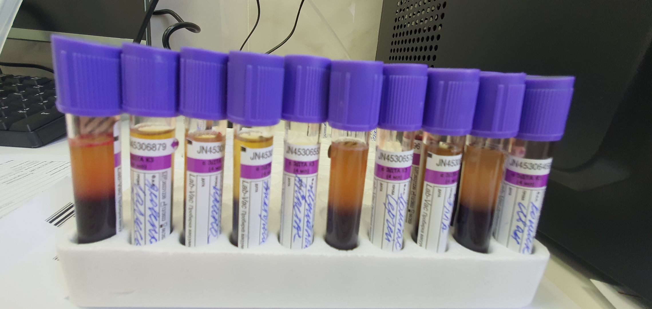 Минздрав Московской области, вакцинация, опасные заболевания, корь