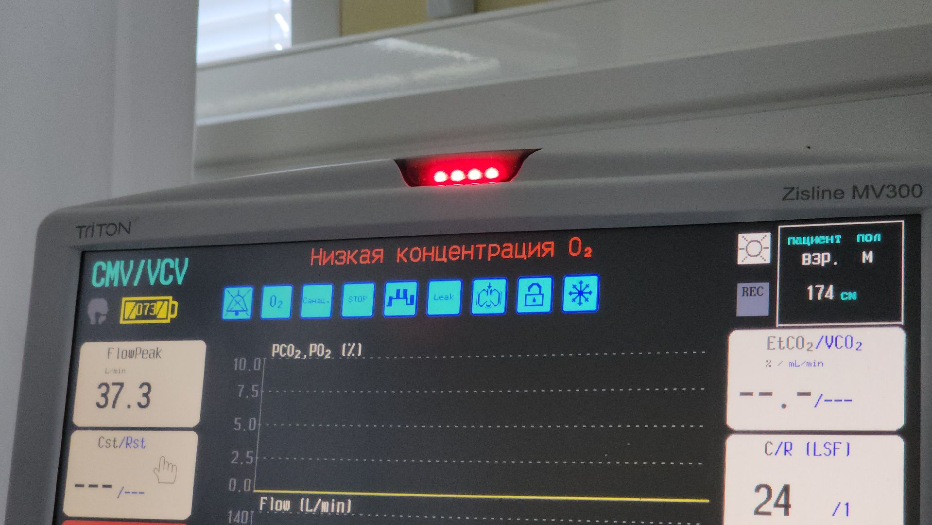 медицина, медицина подмосковья, новое медоборудование, новые аппараты ИВЛ, рузская больница, руза, тучково,