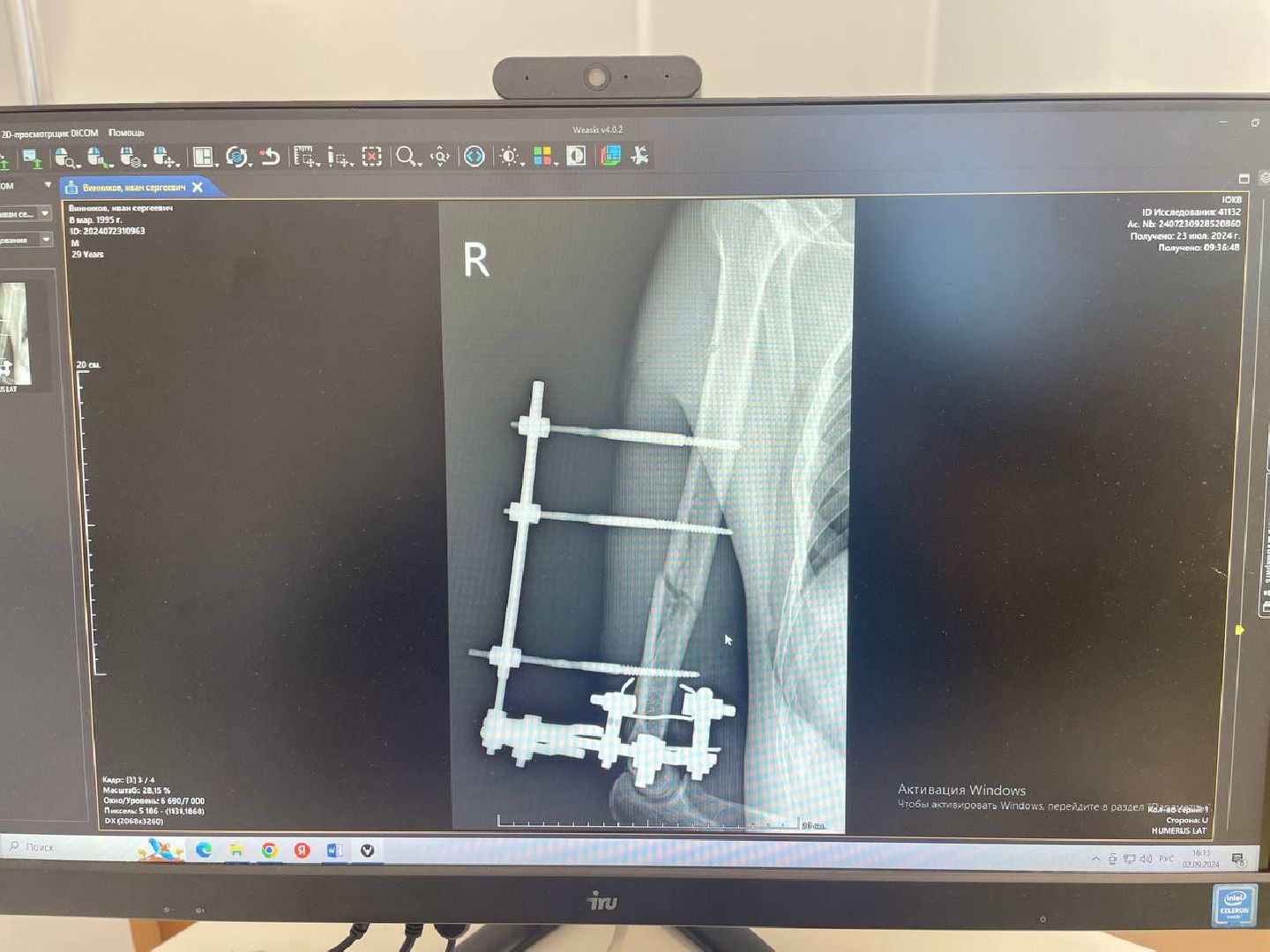 спасение пациента, травматология, мотоциклы,