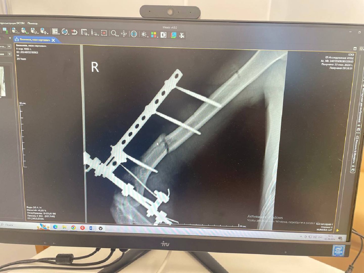 спасение пациента, травматология, мотоциклы,
