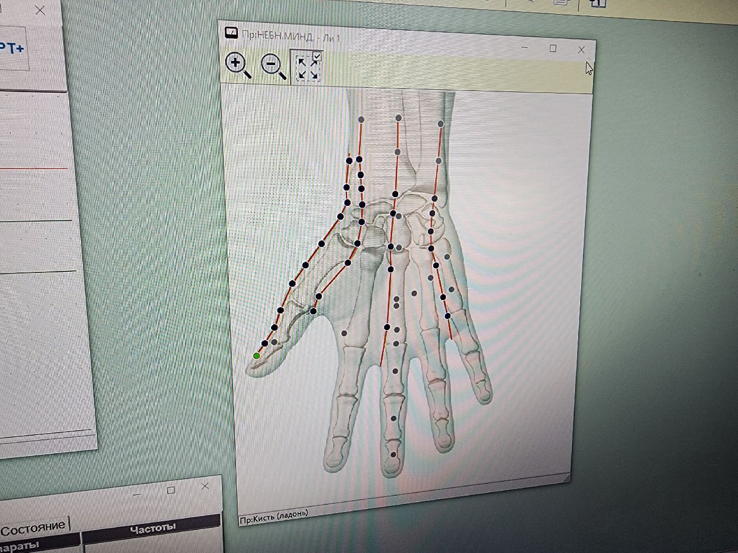 Подольск, реабилитационный центр, Ясенки, Оборудование,