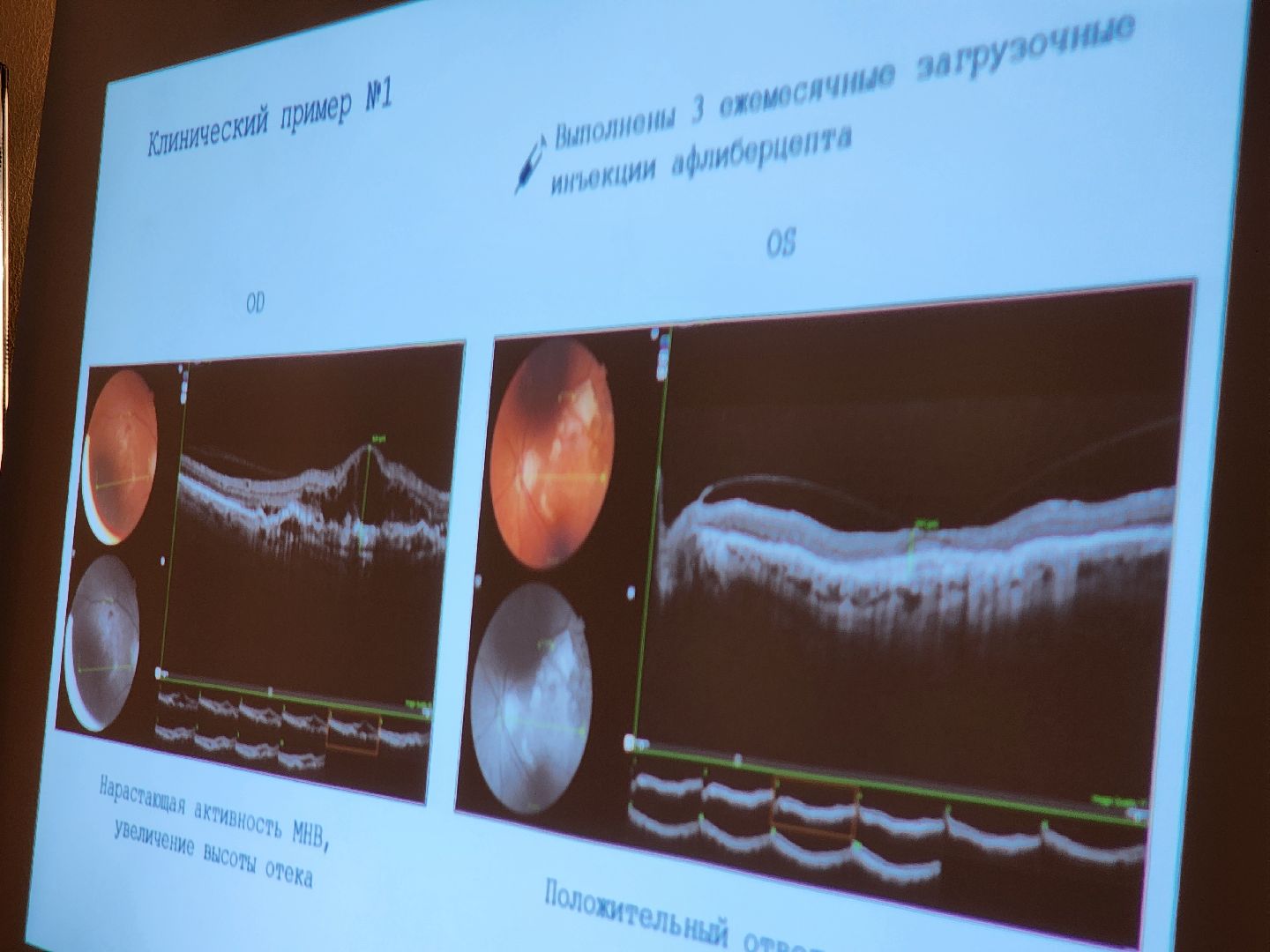 Подольск, Болезни глаз, Медицина, Конференция, моники, покб,