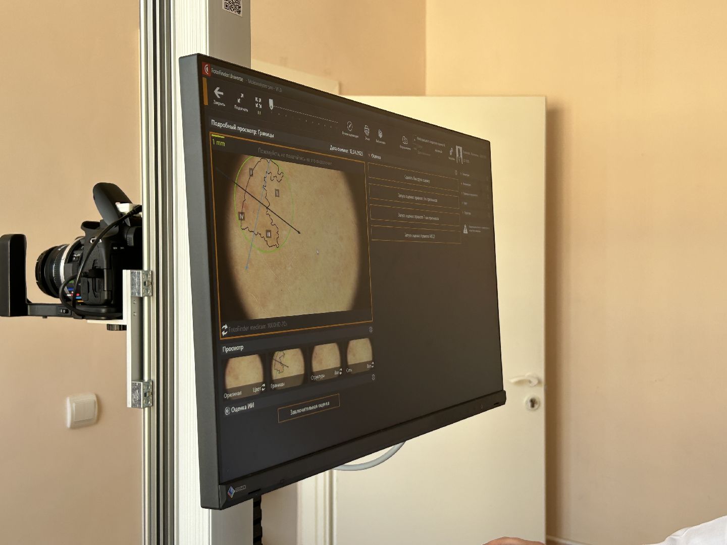 медицина, новое оборудование, Фрязино, рак, онкология, кожа