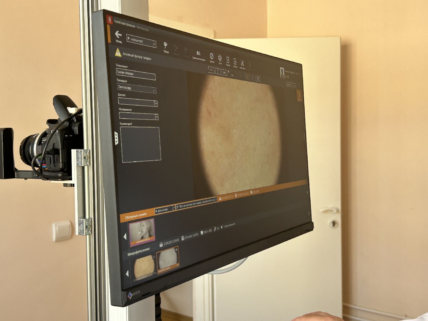 медицина, новое оборудование, Фрязино, рак, онкология, кожа