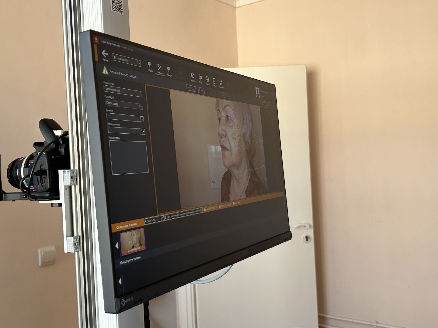 медицина, новое оборудование, Фрязино, рак, онкология, кожа