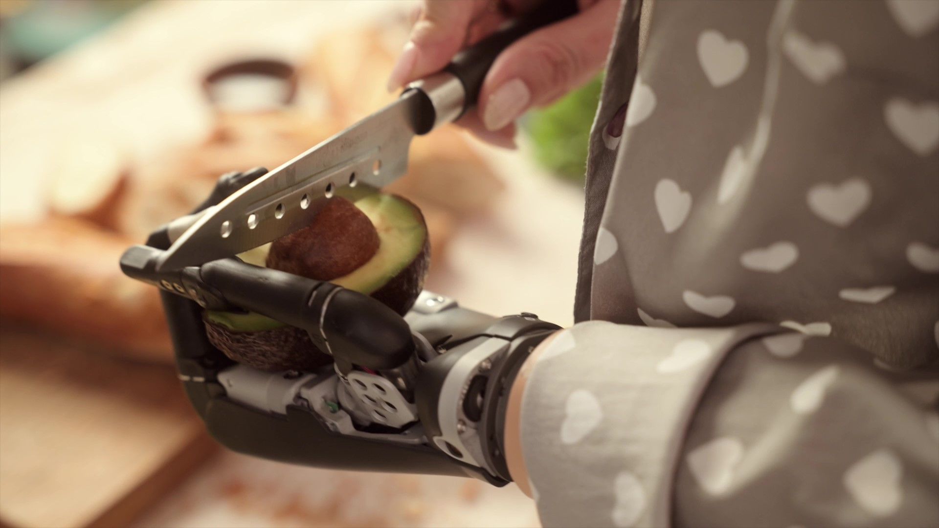 компания МЕТИЗ, протезы, конечности, фестиваль социальной рекламы, киборг, проект, награждение,