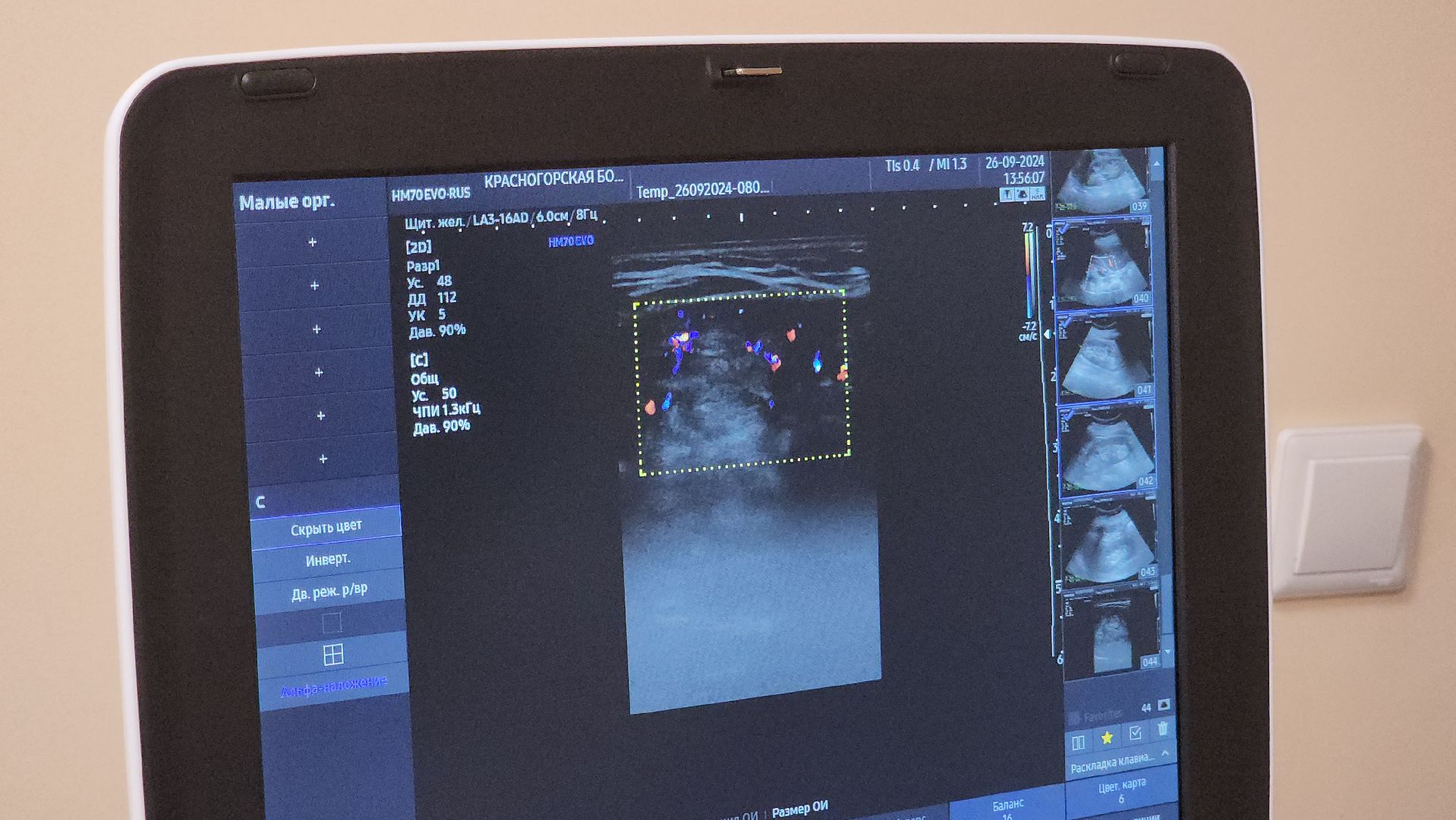 красногорск, медицина, узи, поликлиника,