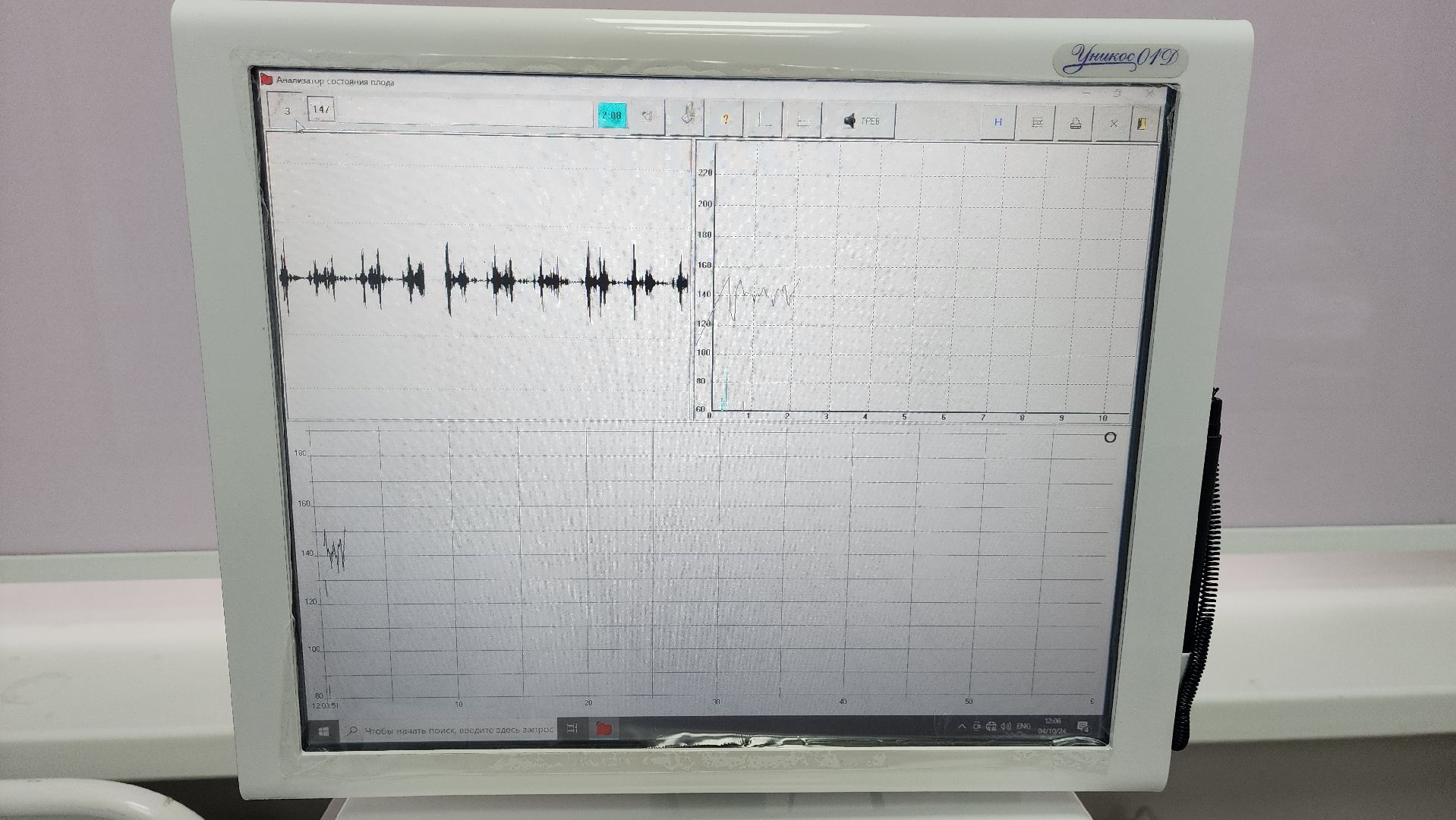 Солнечногорск, медицина, женская консультация, женщины, медицинское оборудование,