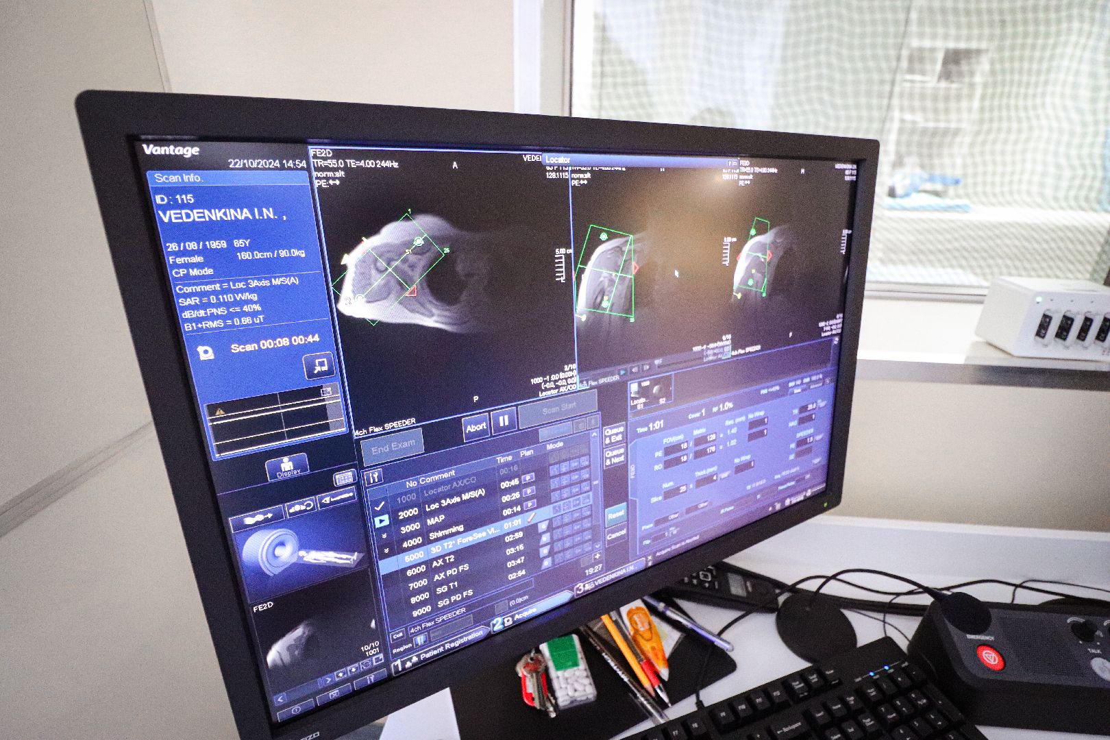 Клин, общество, медицина, новый аппарат МРТ,