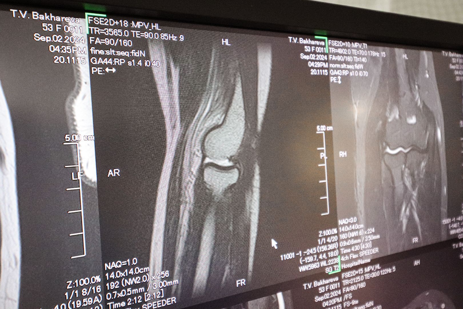 Клин, общество, медицина, новый аппарат МРТ,