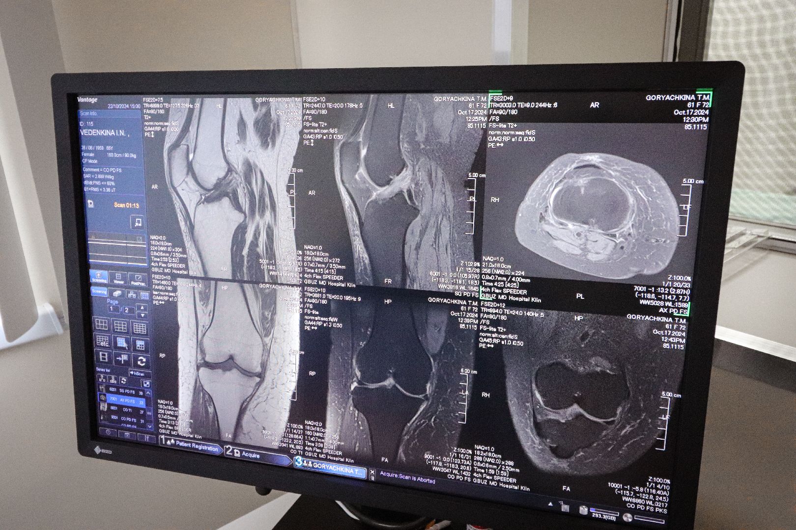 Клин, общество, медицина, новый аппарат МРТ,