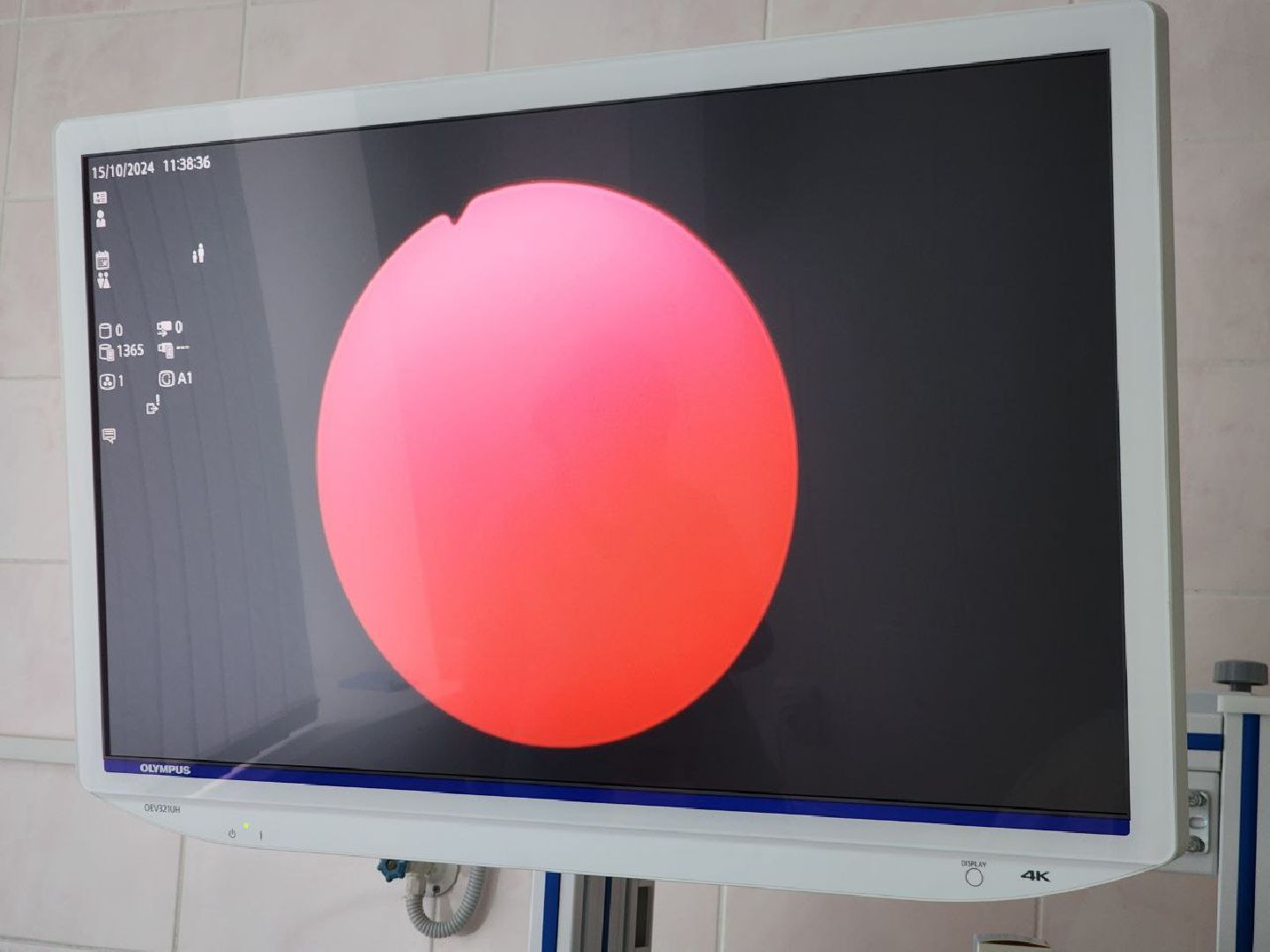 руза, рузский городской округ, медицина, здравоохранение подмосковья, диагностика и лечение, пациенты, гинекологическое оборудование, гинекологическое отделение, новое оборудование, высокотехнологическое оборудование,