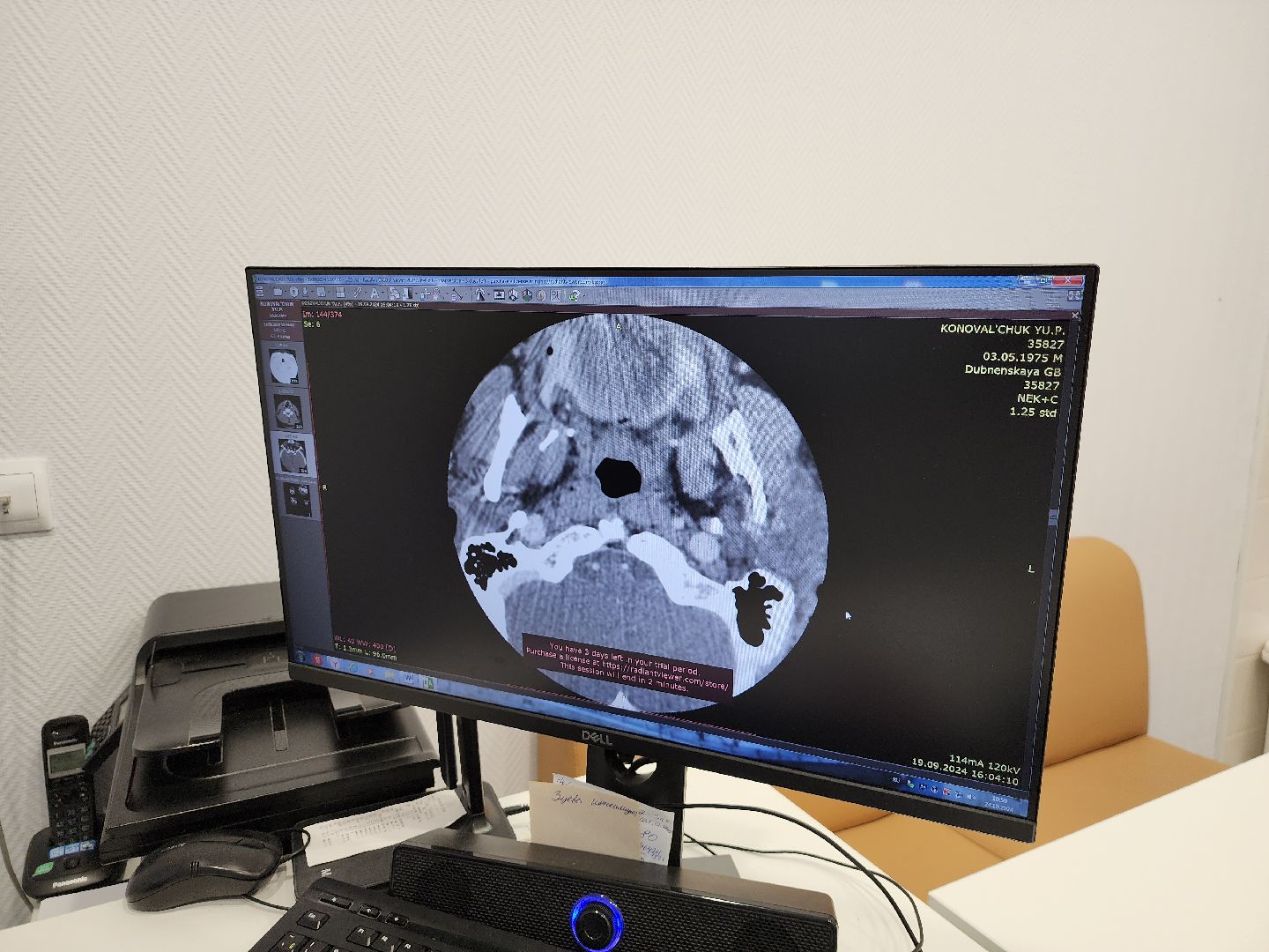 Дубна, фбуз мсч №9 фмба россии, Сосудистый центр, Операция, Профилактика инсульта,