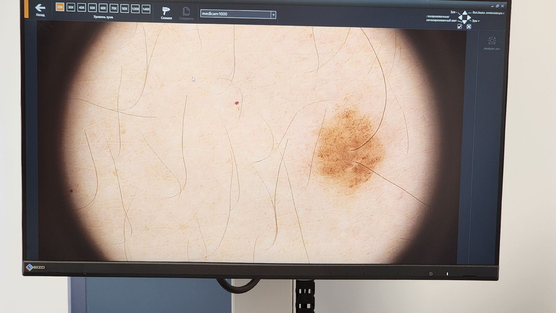 Солнечногорск, центральная поликлиника, медицина, центр онкологической помощи, онкоскрининг,