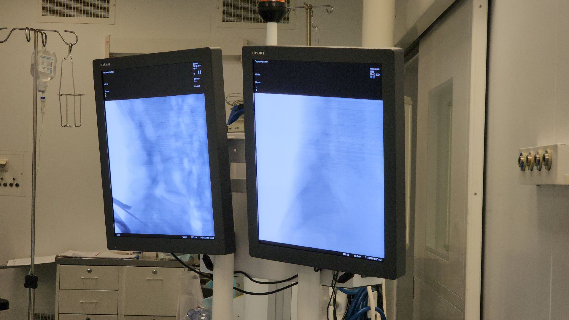 Грыжи, Микрохирургия, Долгопрудный,