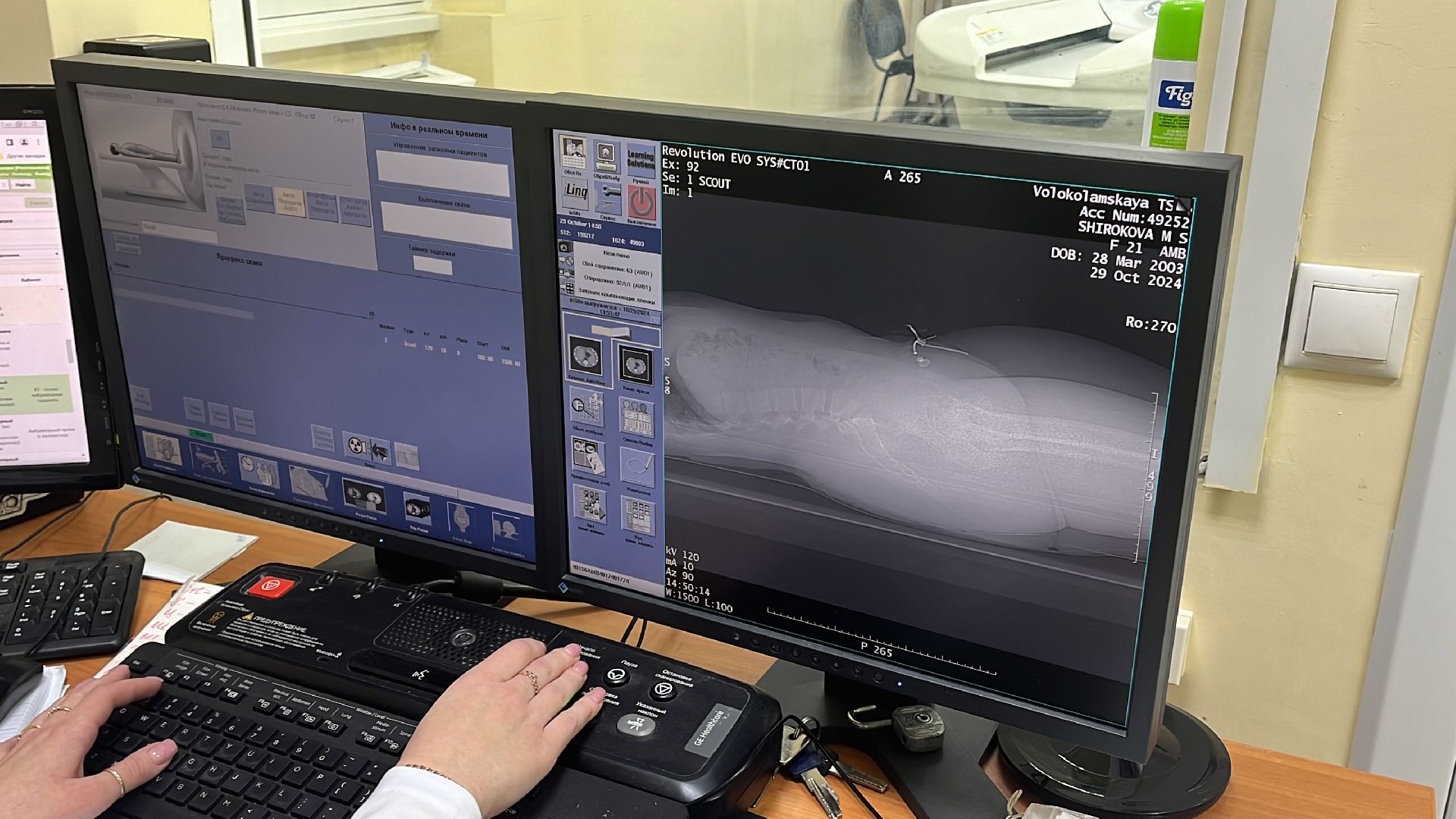 волоколамск, КТ, компьютерная томография, медицина,