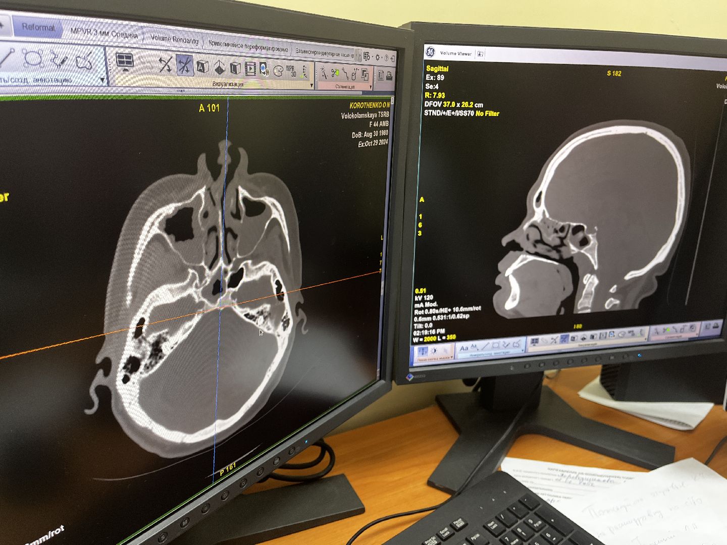 волоколамск, КТ, компьютерная томография, медицина,
