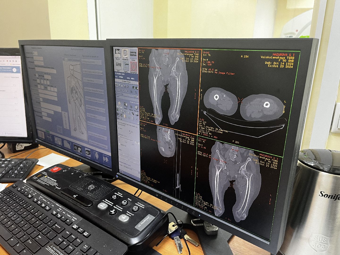 волоколамск, КТ, компьютерная томография, медицина,