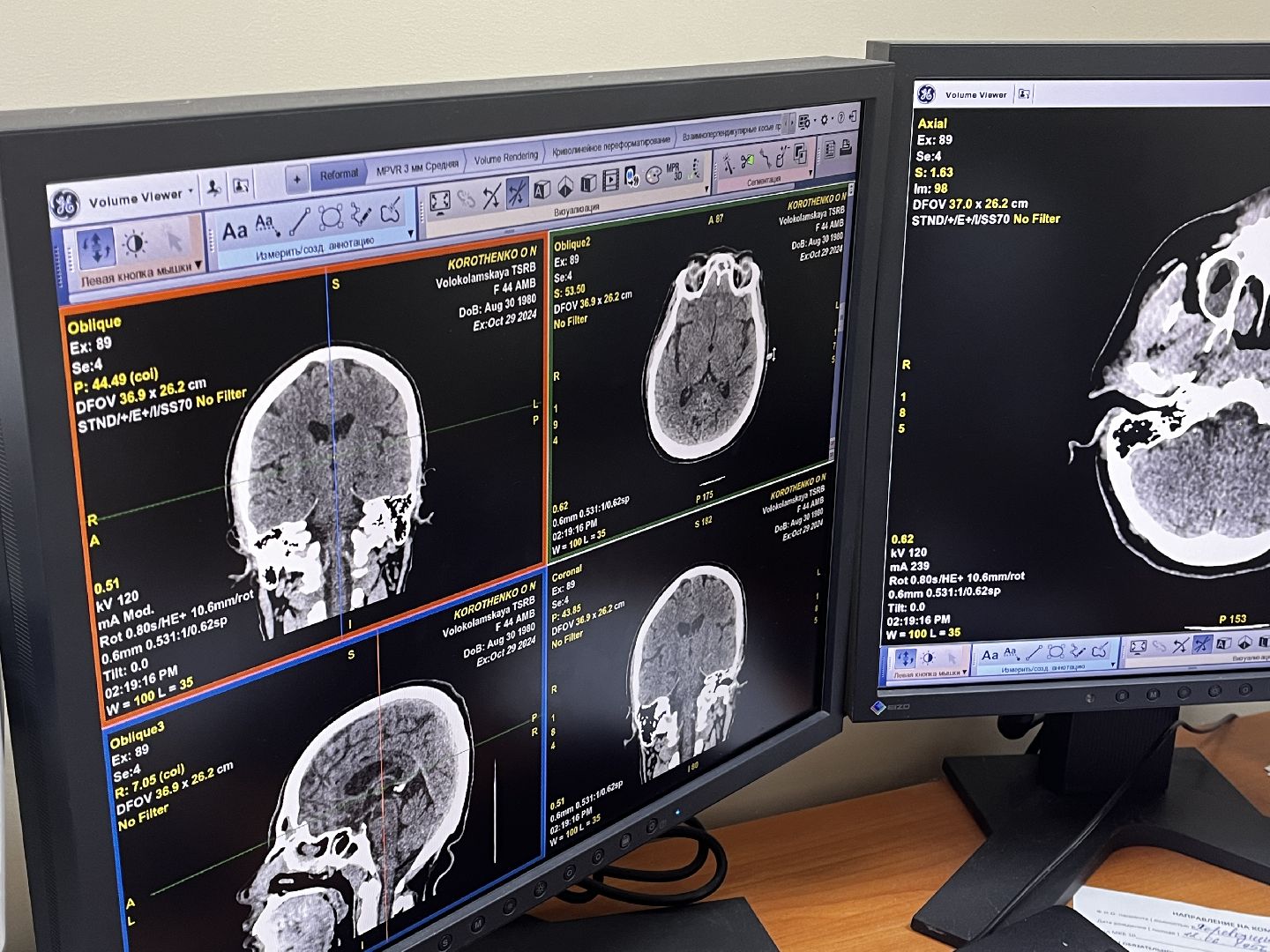 волоколамск, КТ, компьютерная томография, медицина,