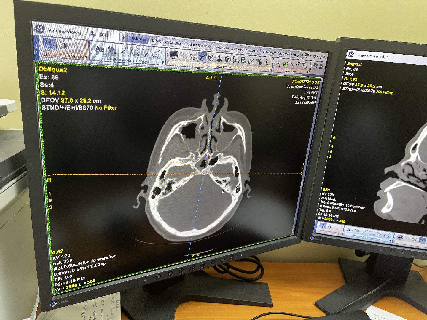 волоколамск, КТ, компьютерная томография, медицина,