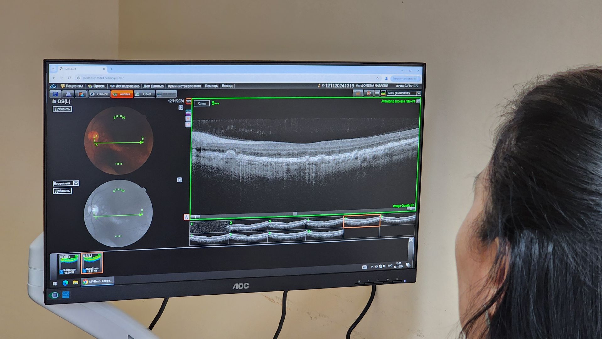 протвино, медициона, медицинское оборудование, поликлиника протвино, кабинет офтальмолога,