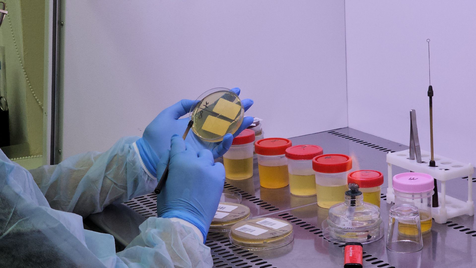 красногорск, больница, антимикробная резистентность, медицина,