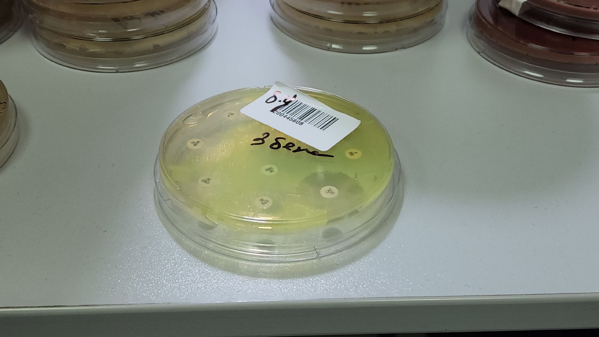 красногорск, больница, антимикробная резистентность, медицина,