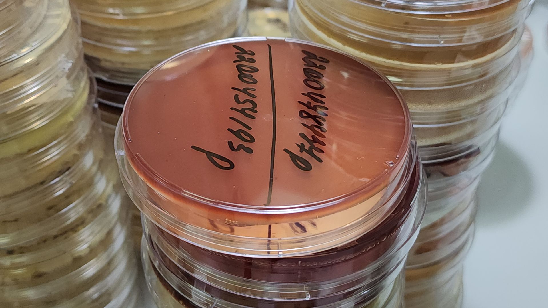 красногорск, больница, антимикробная резистентность, медицина,