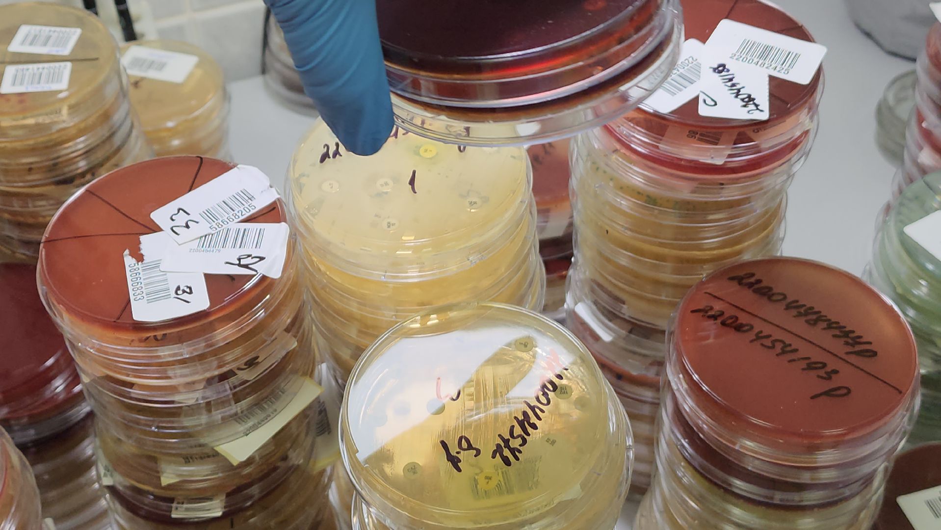 красногорск, больница, антимикробная резистентность, медицина,