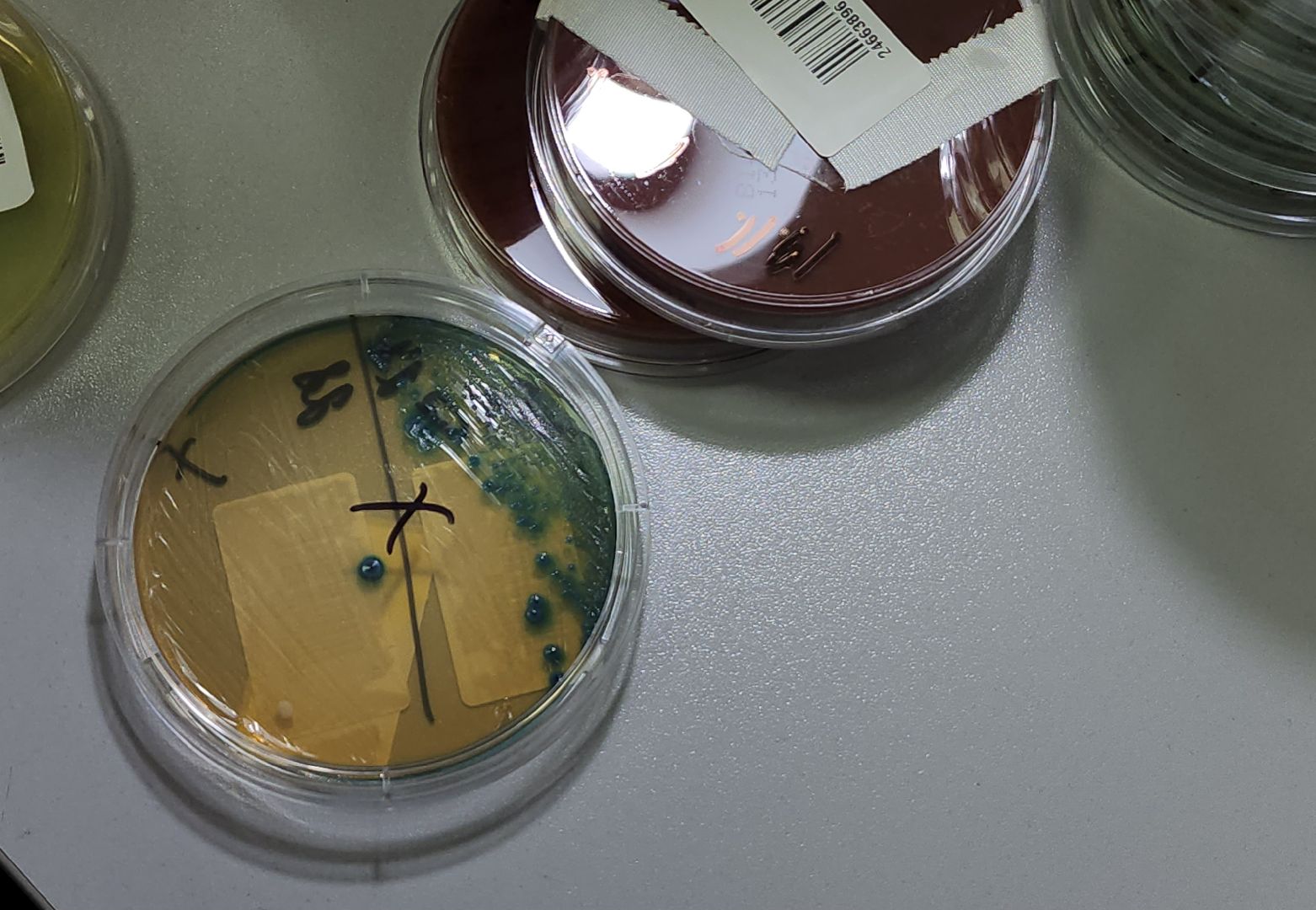 красногорск, больница, антимикробная резистентность, медицина,