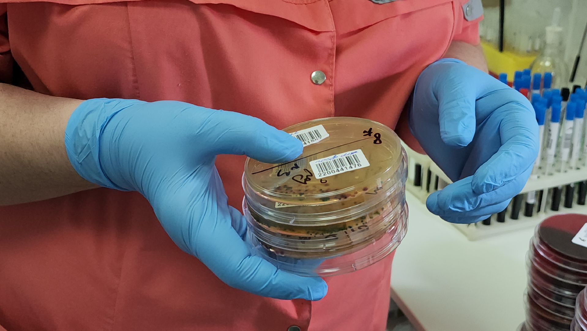 красногорск, больница, антимикробная резистентность, медицина,