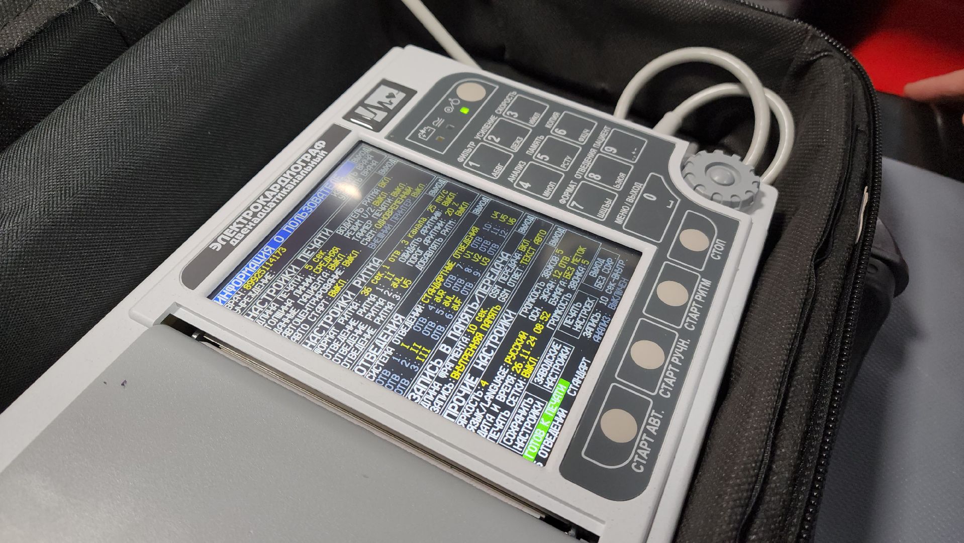 кардиопульт, кардиограмма, экг, скорая помощь, красногорск,