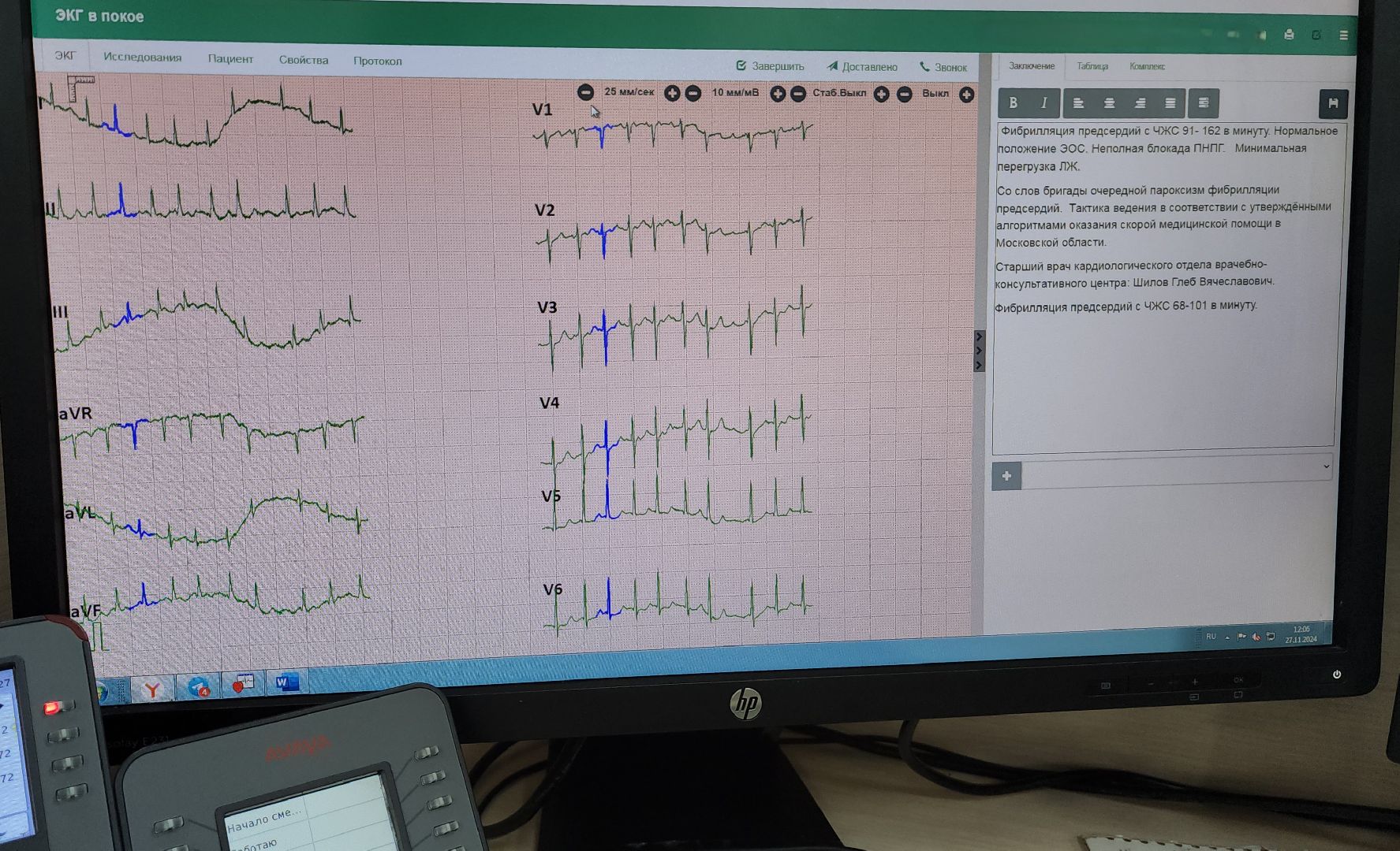 кардиопульт, кардиограмма, экг, скорая помощь, красногорск,