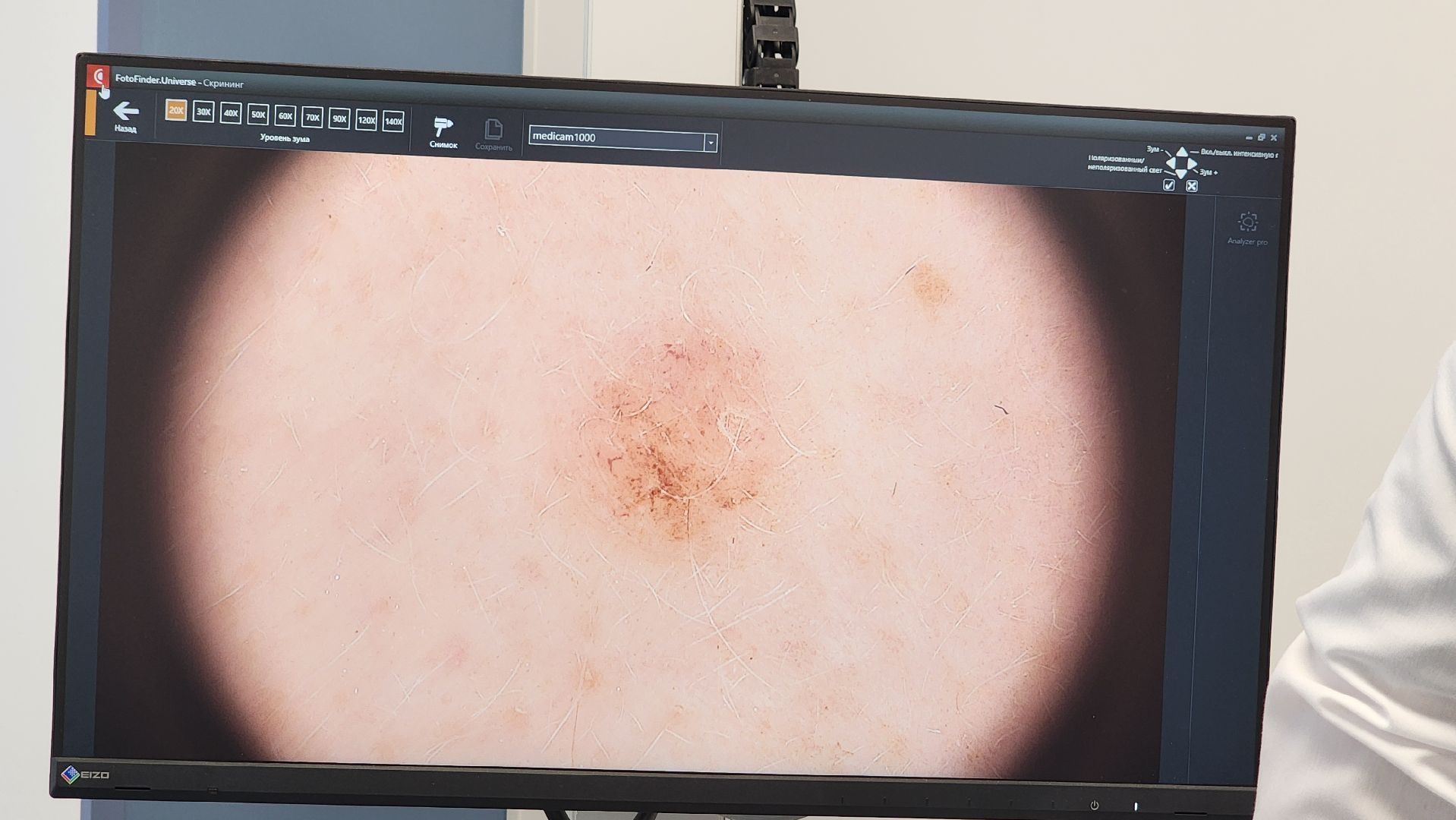 Солнечногорск, вертикалки, медицина, онкология, онкоскрининг,