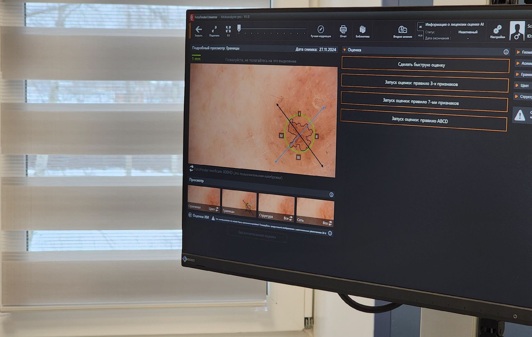 Солнечногорск, вертикалки, медицина, онкология, онкоскрининг,