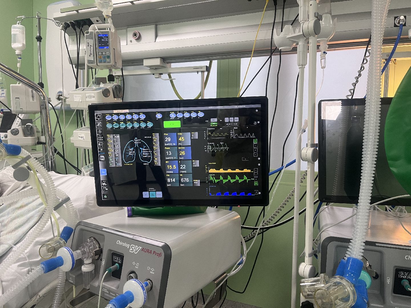 ивл, искусственная вентиляция легких, аппарат, новый аппарат, аппарат ивл,