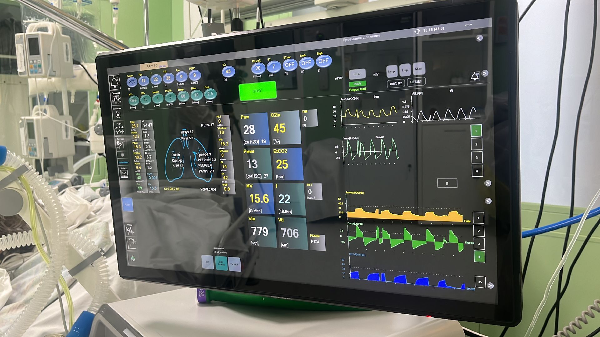 ивл, искусственная вентиляция легких, аппарат, новый аппарат, аппарат ивл,