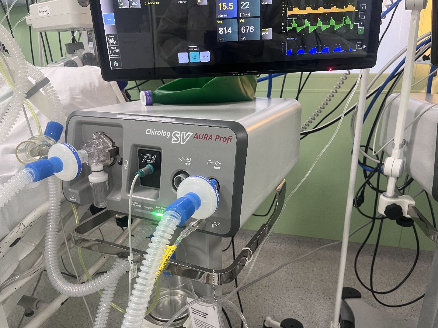 ивл, искусственная вентиляция легких, аппарат, новый аппарат, аппарат ивл,