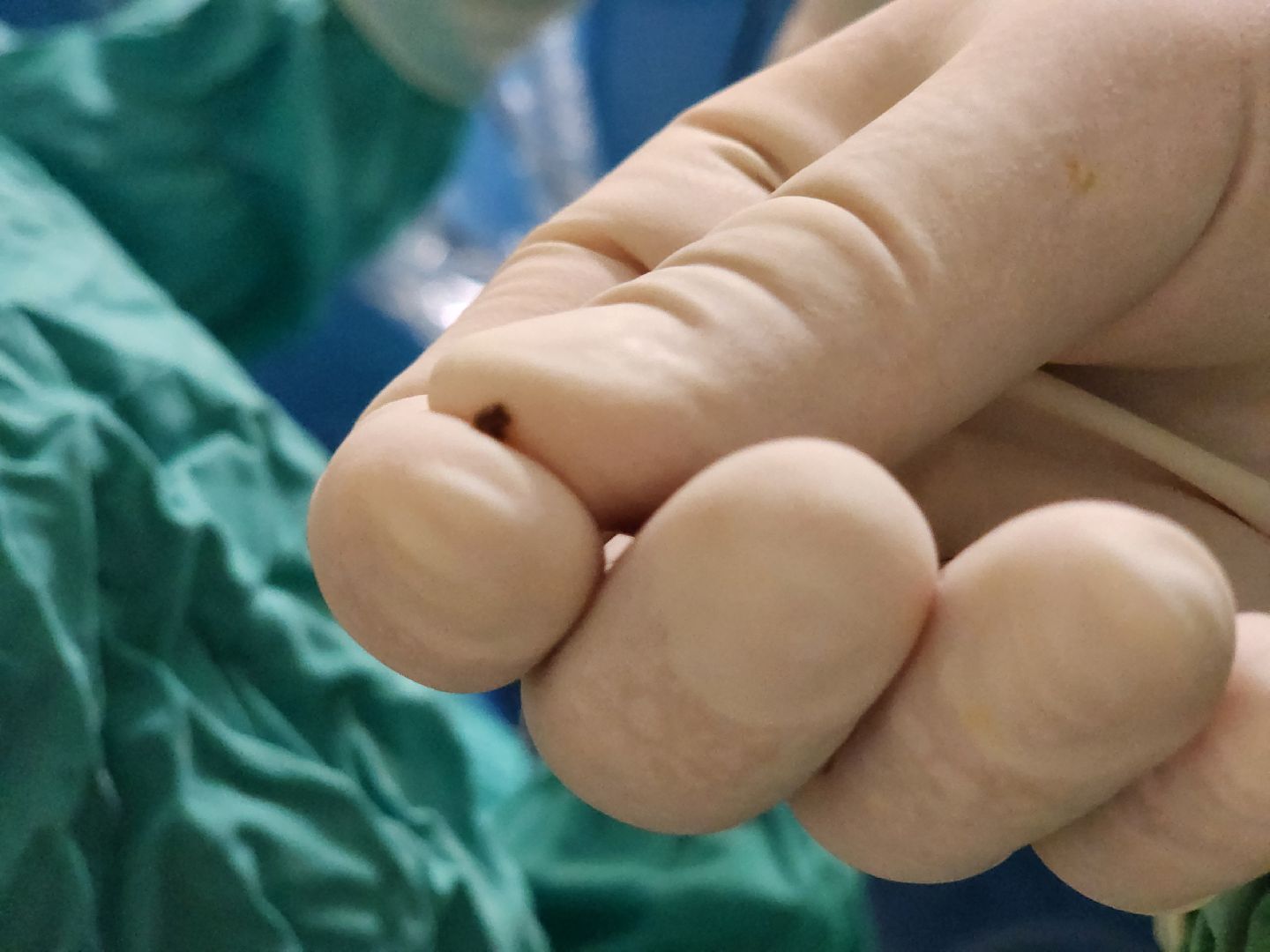 воскресенск, медицина, урология, операции,