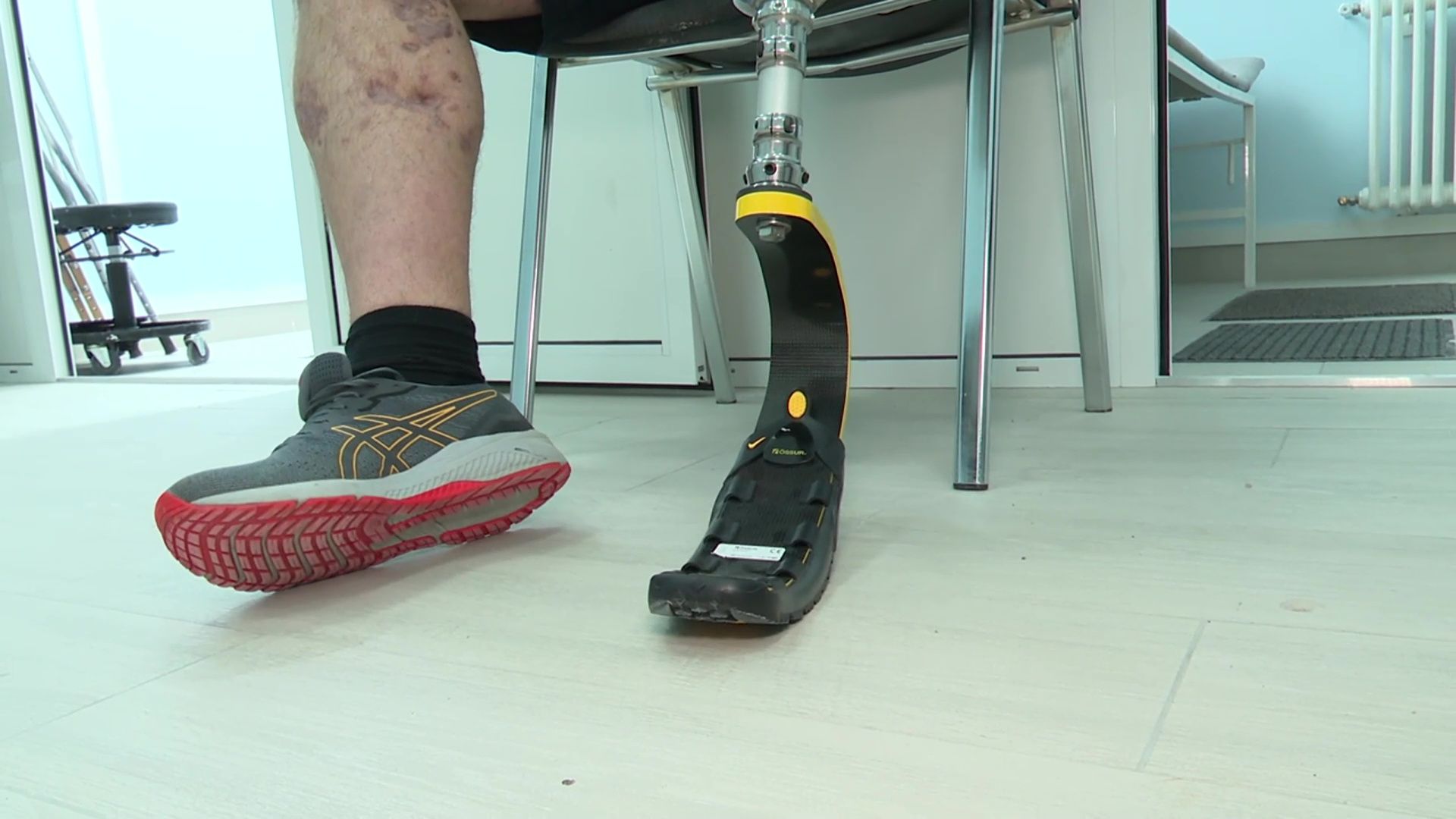 Реутов, вертикалки, центр ортопедии, протезы, протез для военнослужащего, СВО, протез ноги,