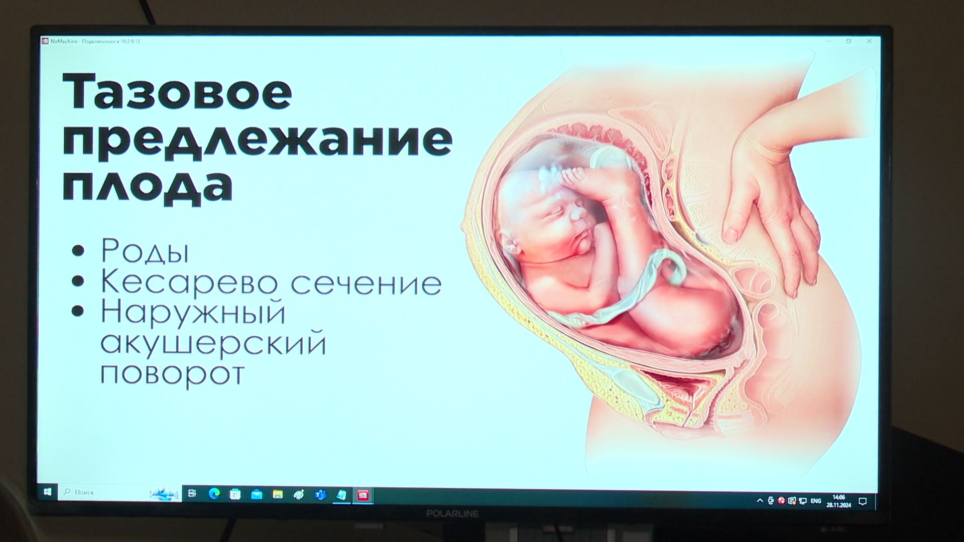 Реутов, вертикалки, школа мам, роддом, медицина, здравоохранение,роддом саввино,