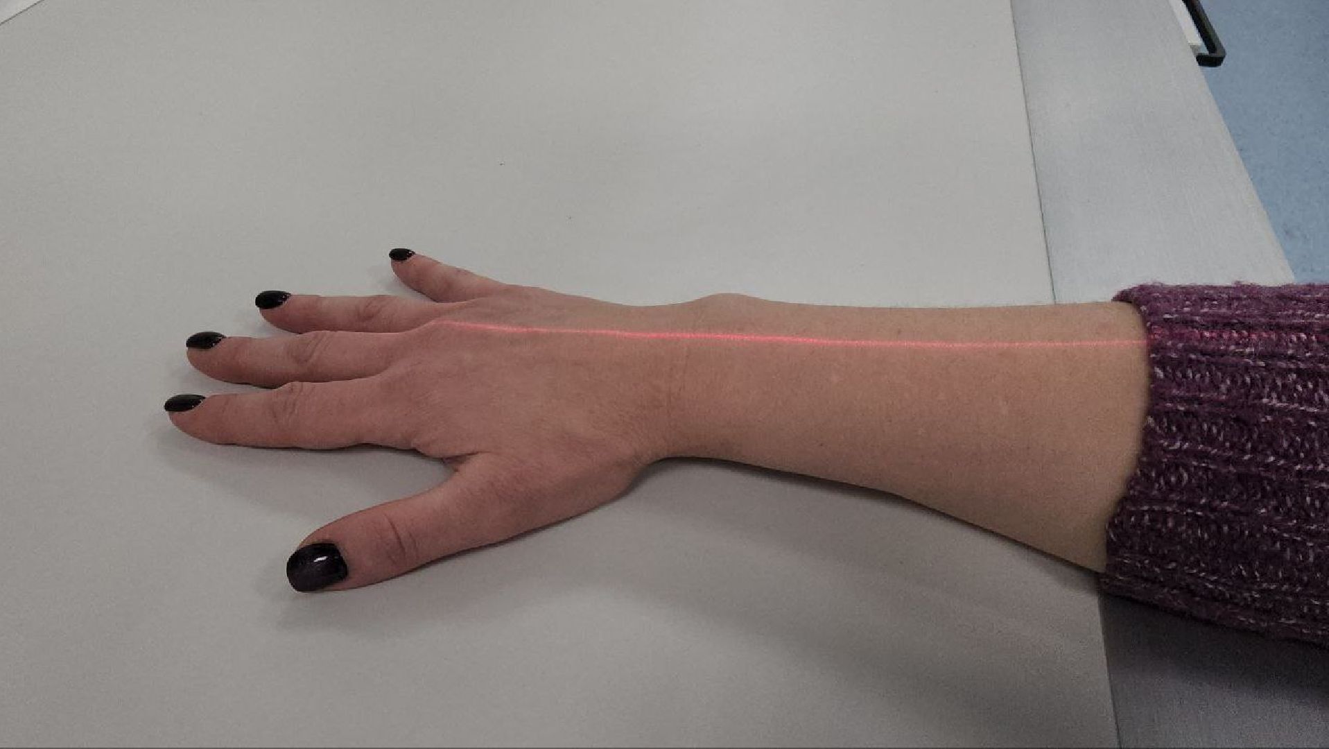 люберцы, центральная поликлиника, люберецкая больница, рентген-кабинет,