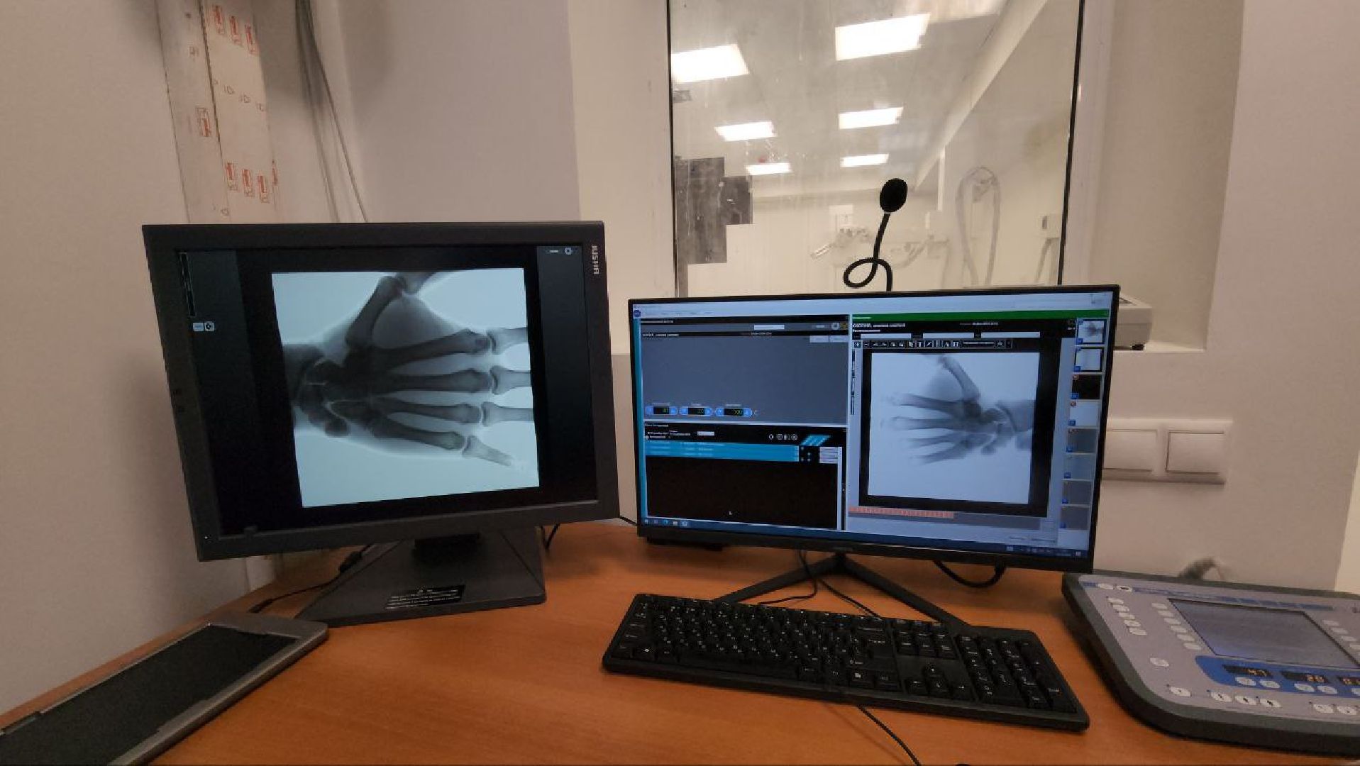 люберецкая больница, Центральная поликлиника Люберец, новый рентген-аппарат, пациенты,цифровой ортопантомограф,