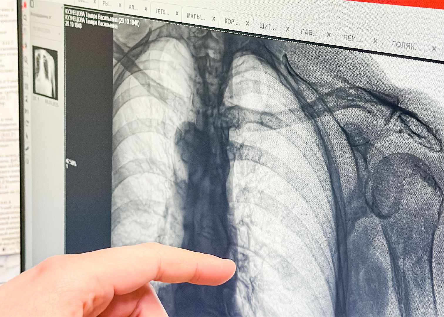 Клин, общество, медицина, травмы, гололед,