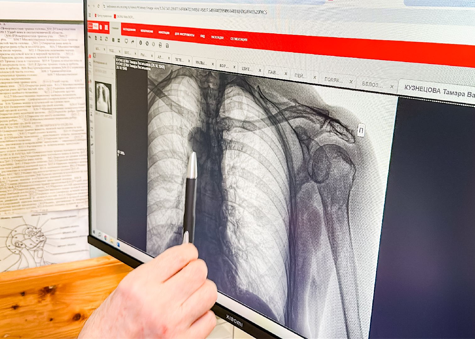 Клин, общество, медицина, травмы, гололед,