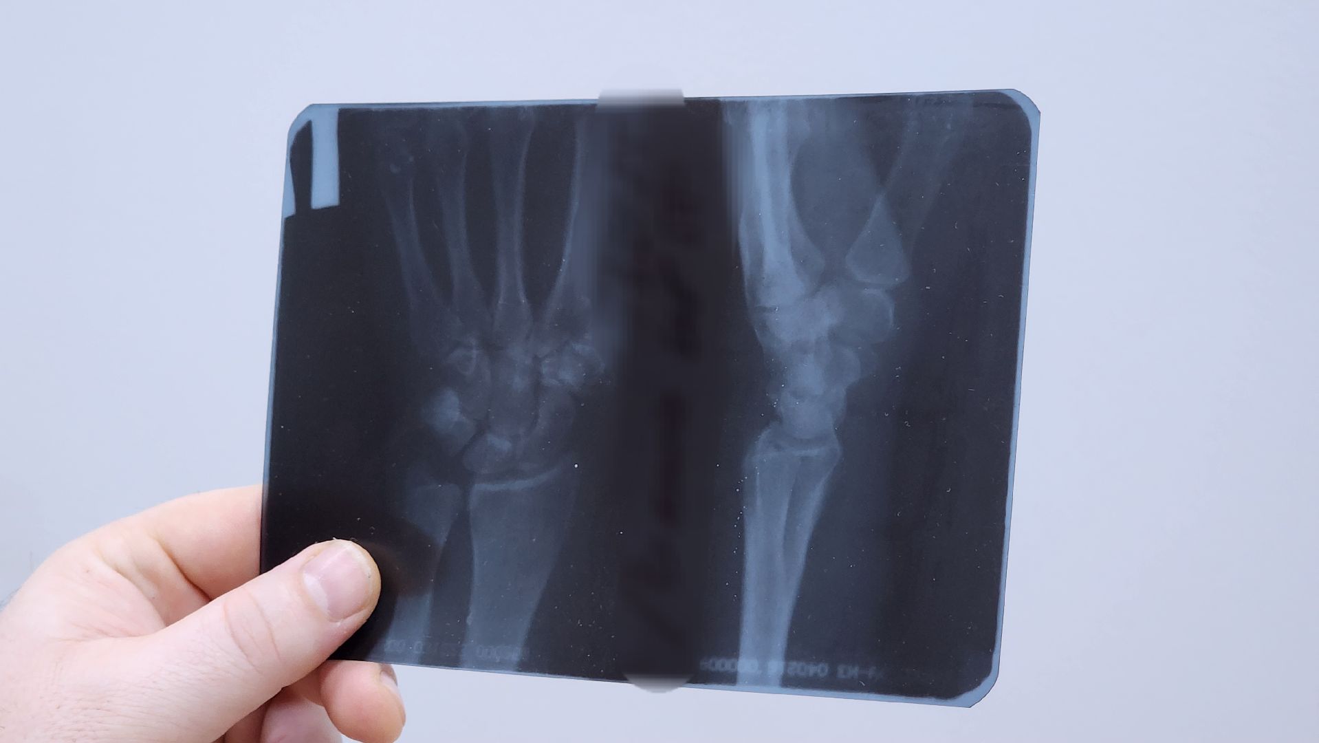 Солнечногорск, медицина, травматология, гололед,